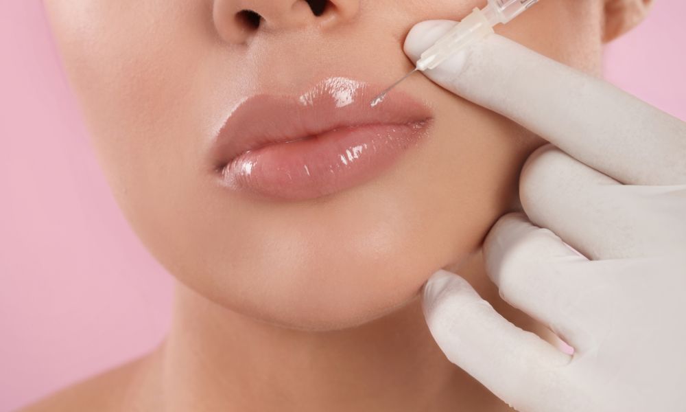 Lip Filler Injection