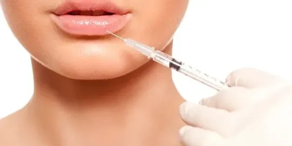 Dermal Fillers