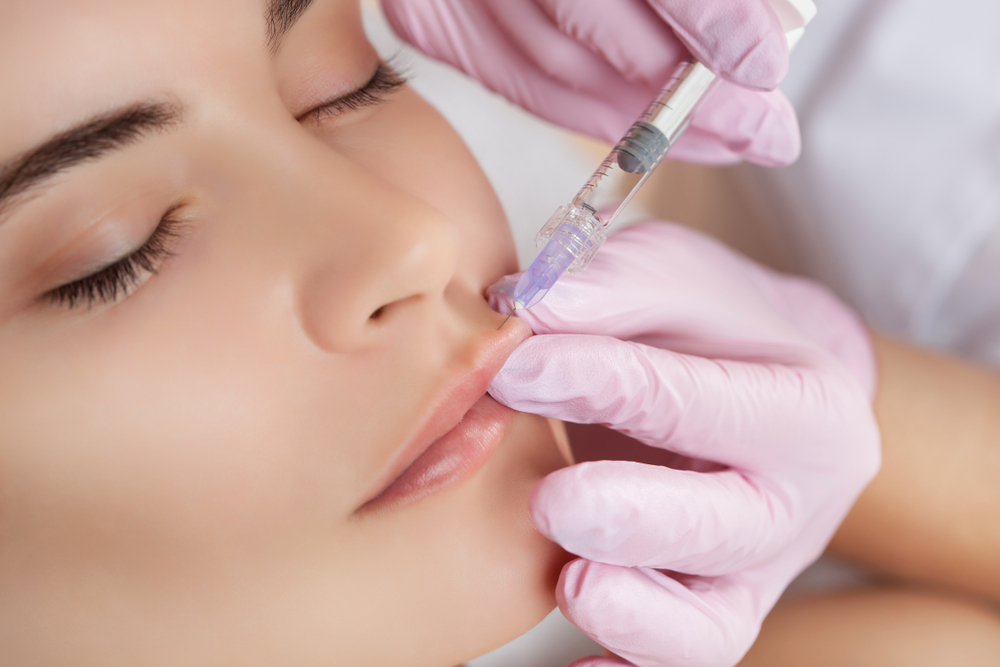 Botox Lip Flip Alexandria Virginia