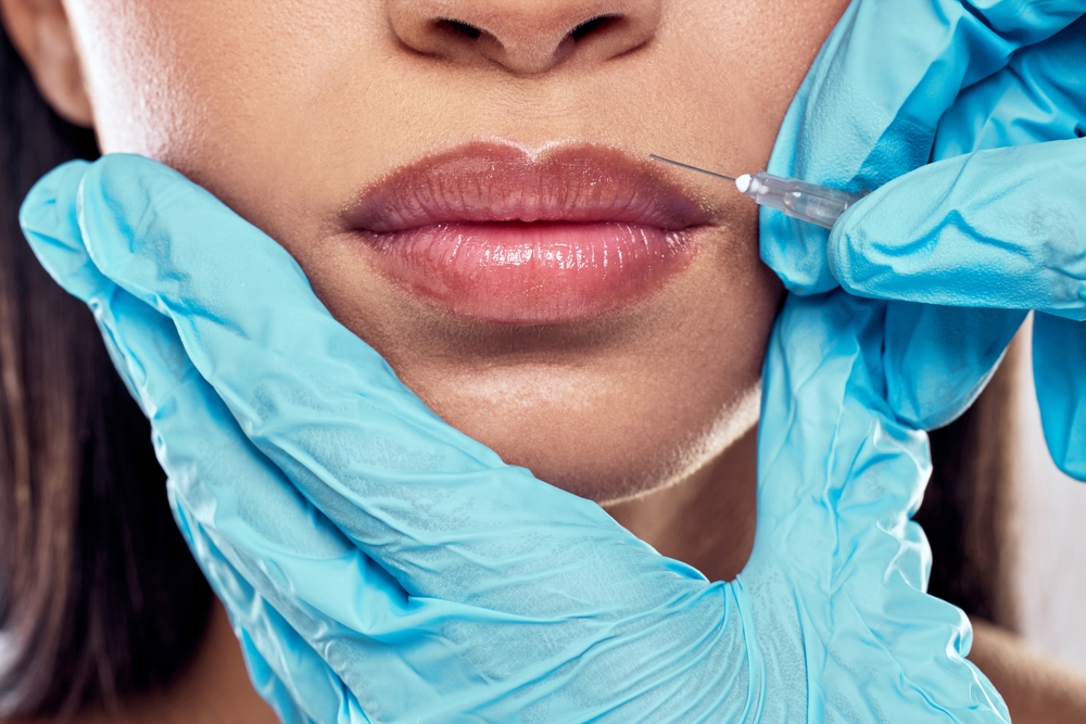 Longest Lasting Lip Filler