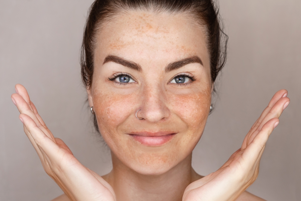Full-Face Botox Cost in Northern Virginia: A Price Guide