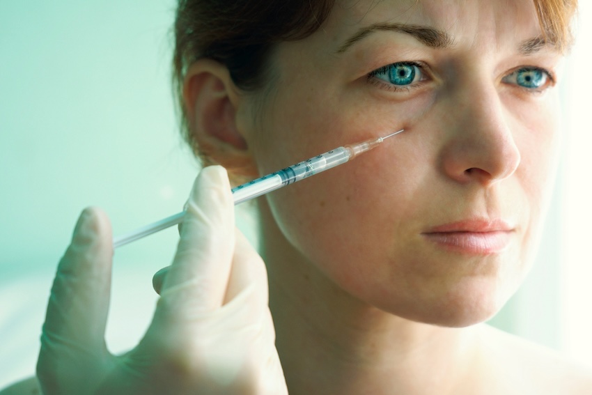 Under Eye Filler Treatment Alexandria, VA Tear Trough Filler Results