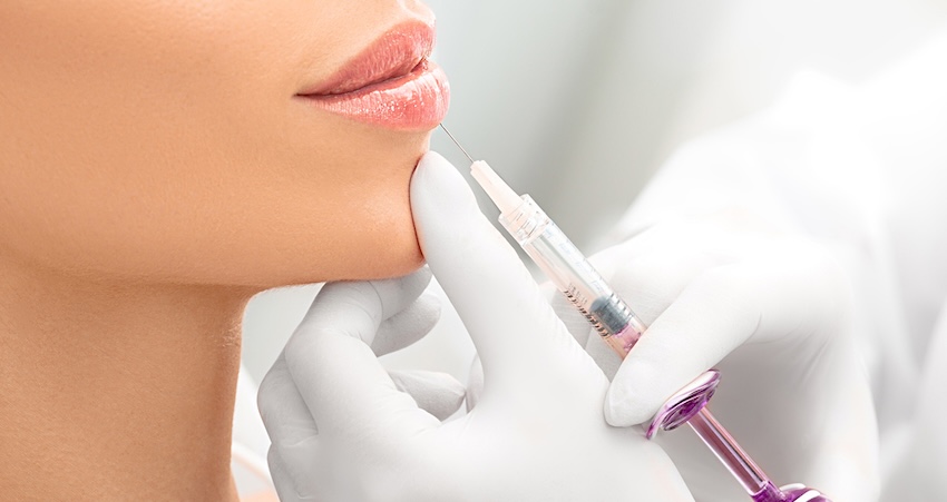 Best Lip Filler Injections in Alexandria, VA