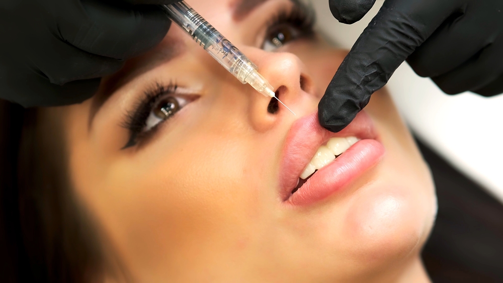 Dermal Filler Appointment Near Alexandria Virginia