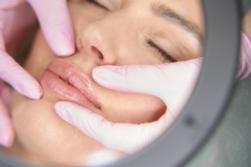 What Happens at a Lip Filler Consultation Appointment in Alexandria, Virginia?